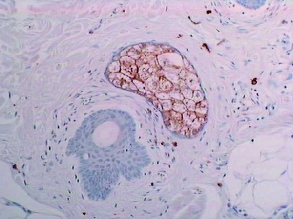 Human glandula sebacea