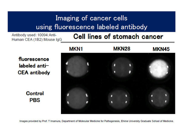 Imaging of cancer cells using fluorescence labeled antibody / Image provided by Prof. T Imamura, Department of Molecular Medicine for Pathogenesis, Ehime University Graduate School of Medicine.