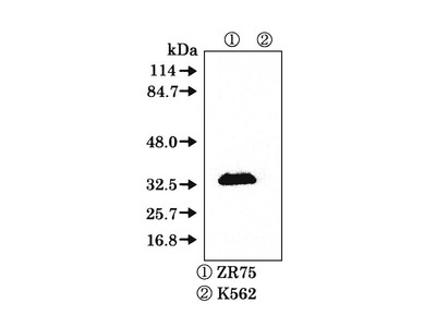 #11011 Anti- Bcl-1/Cyclin D1 (5D4) Mouse MoAb