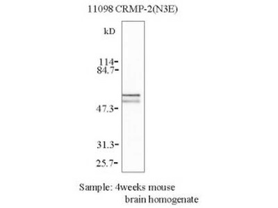 #11098 Anti-Human  CRMP-2 (N3E) Mouse IgG MoAb