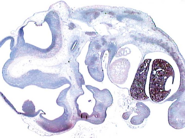 Balb/c マウス胚 (X 20)