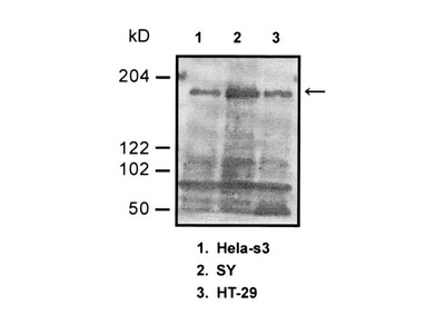 #18871 Anti-Human DNMT-1 (DNA Methyltransferase-1) Rabbit IgG Affinity Purify