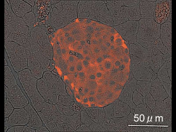 免疫蛍光染色、マウス膵臓ランゲルハンス島 (生後6ヶ月) X40