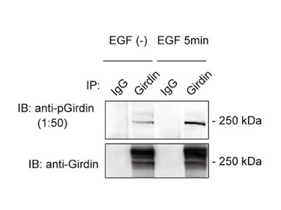 #28067 Anti-Human Girdin (S1416 Phosphorylated) Rabbit IgG Affinity Purify