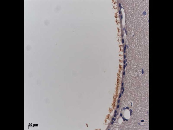 Rat choroid plexus cells (cillia, ependyma cells), Around ventricle