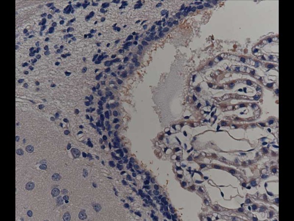Rat choroid plexus cells (cillia, ependyma cells), Around ventricle