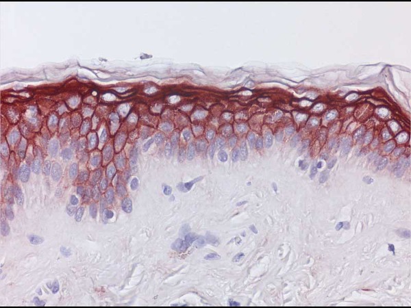 Human Skin, Photo of IHC staining is kindly provided by Dr. Michael Ploug, Finsen Laboratory, Rigshospitalet, Copenhagen Biocenter, Copenhagen, Denmark.