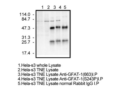 #28123 Anti-Human GFAT1 (S243 Phosphorylated) Rabbit IgG Affinity Purify