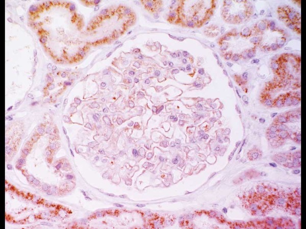 Human renal glomerular (DAB)