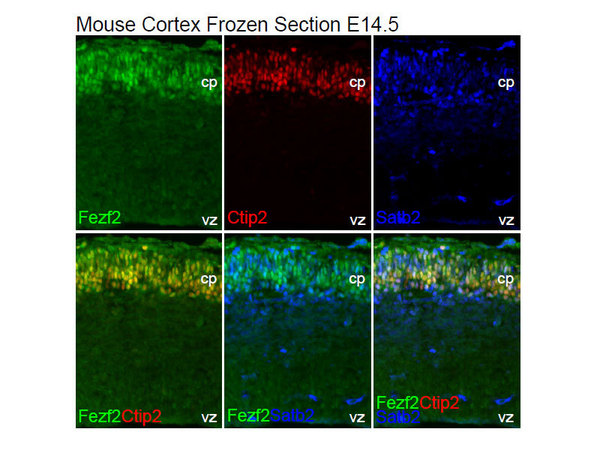 Images provided by: Dr. K. Toma, Laboratory for Neocortical Development, RIKEN Center for Developmental Biology / Related reference: The timing of upper-layer neurogenesis is conferred by sequential derepression and negative feedback from deep-layer neurons. Toma et al. J Neurosci. 2014 Sep 24;34(39):13259-76