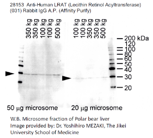 W.B. Microsome fraction of Polar bear liver Image provided by: Dr. Yoshihiro MEZAKI, The Jikei University School of Medicine