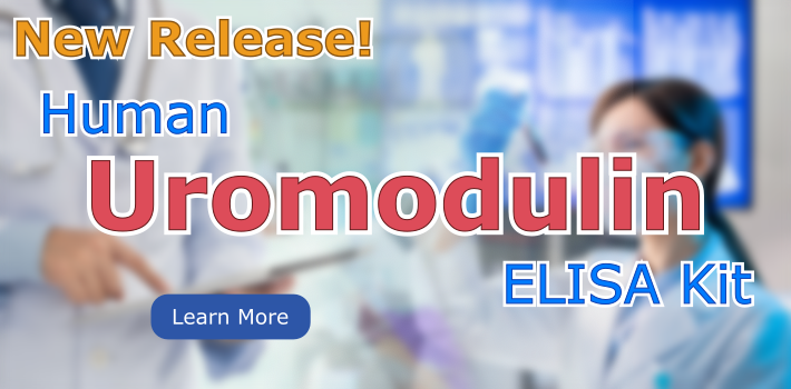 New Release! Human Uromodulin ELISA Kit