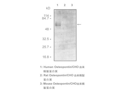 #10011 Anti-Human Osteopontin (10A16) Mouse IgG MoAb