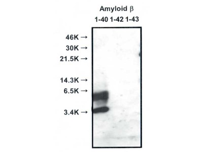 #10047 Anti-Human Amyloidβ (35-40) (1A10) Mouse IgG MoAb
