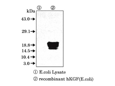 #10131 Anti-Human KGF (5J2) Mouse IgG MoAb