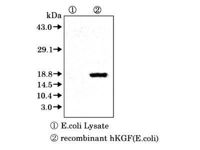 #10135 Anti-Human KGF (11F1) Mouse IgG MoAb