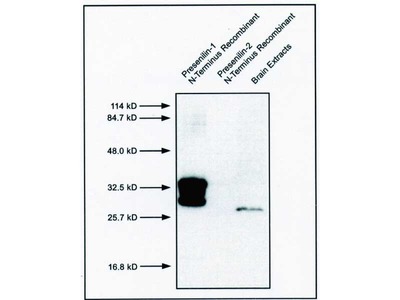 #10151 Anti-Human Presenilin-1 (17C2) Mouse IgG MoAb