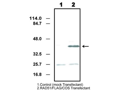 #10161 Anti-Human Rad 51 (1B1) Mouse IgG MoAb