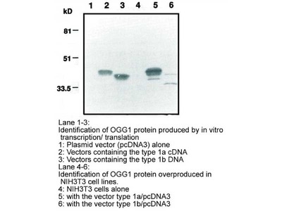 #10171 Anti-Human OGG1 (7E2) Mouse IgG MoAb