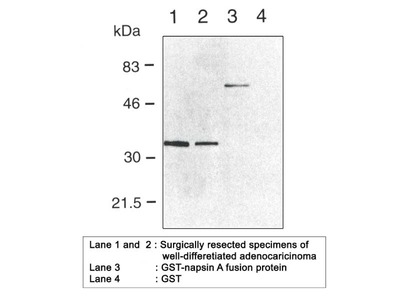 #10221 Anti-Human Napsin A (TMU-Ad02) Mouse IgG MoAb