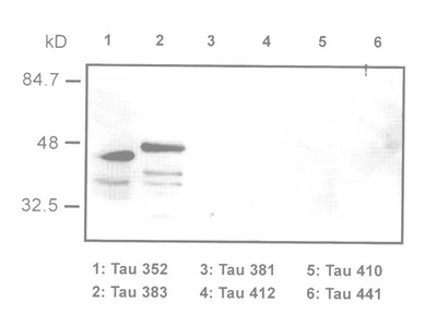 #10233 Anti-Human Tau/Amino Junction (9A1) Mouse IgG MoAb