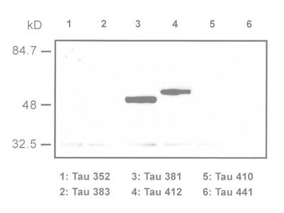#10235 Anti-Human Tau/E2 Junction (1A1) Mouse IgG MoAb