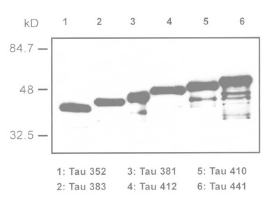 #10237 Anti-Human Tau/Repeat Domain (2B11) Mouse IgG MoAb