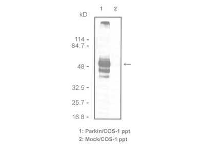 #10241 Anti-Human Parkin (1A1) Mouse IgG MoAb