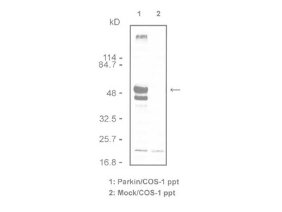 #10243 Anti-Human Parkin (5A1) Mouse IgG MoAb