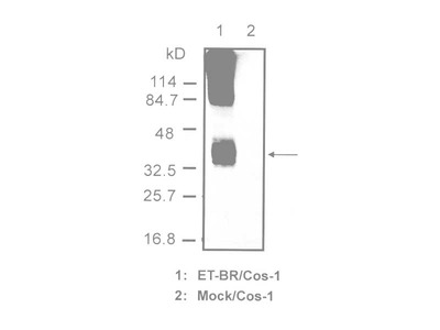 #10253 Anti-Human Endothelin-B Receptor (8Z11) Mouse IgG MoAb