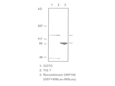 #10301 Anti-Human ORP150 (Oxygen Regulated Protein, p150) (2F07) Mouse IgG MoAb