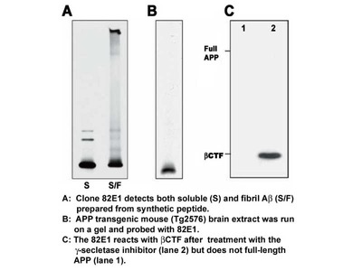 #10323 Anti-Human Amyloidβ (N) (82E1) Mouse IgG MoAb