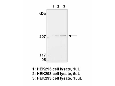 #10343 Anti- mTOR (N5D11) Mouse IgG MoAb