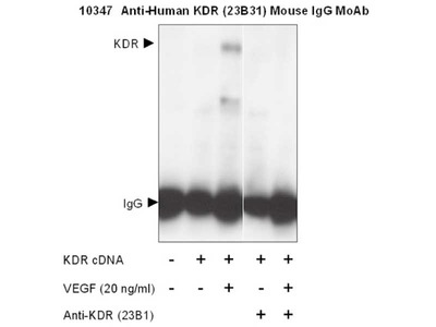 #10347 Anti-Human KDR (23B31) Mouse IgG MoAb