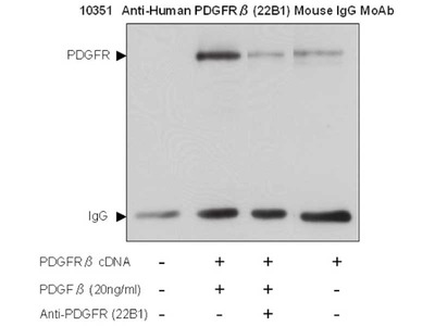 #10351 Anti-Human PDGFRβ (22B1) Mouse IgG MoAb