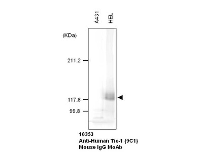 #10353 Anti-Human Tie-1 (9C1) Mouse IgG MoAb