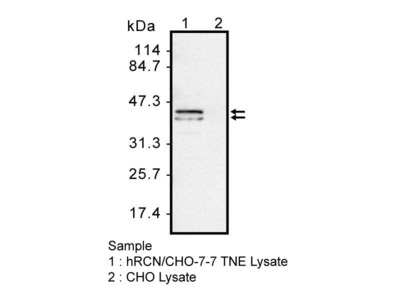 #10367 Anti-Human Reticulocalbin-1 (TMU-6A1) Mouse IgG MoAb