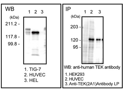 #10369 Anti-Human TEK/Tie-2 (2A1) Mouse IgG MoAb