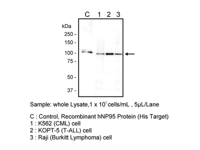 #10371 Anti-Human NP95 (mt40) Mouse IgG MoAb