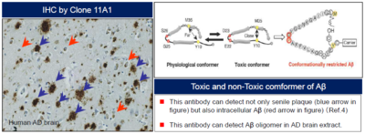 #10379 Anti-Human Amyloidβ E22P (11A1) Mouse IgG MoAb