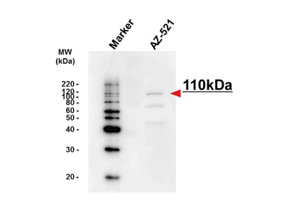 #10411 Anti- DPD (ADPYDMAB) Mouse IgG MoAb