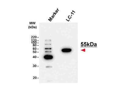 #10413 Anti- TP (ATYMPMAB) Mouse IgG MoAb