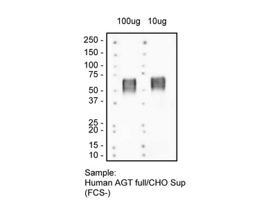 #10417 Anti-Human Angiotensinogen (104AT 601.2.80) Mouse IgG MoAb