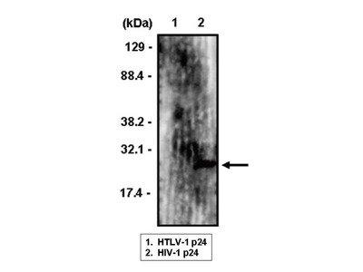 #10903 Anti- HIV-1 p24 (2C2) Mouse IgG MoAb