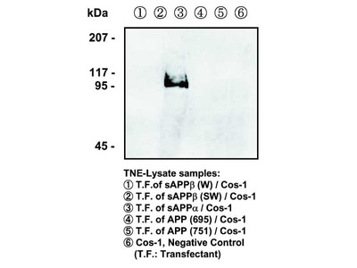 #11088 Anti-Human sAPPα (2B3) Mouse IgG MoAb