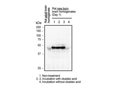 #11092 Anti-Human Tau (Phosphorylated) (C5) Mouse IgG MoAb