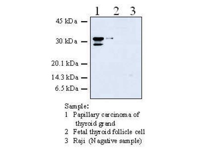 #11100 Anti-Human Galectin-3 (38B2) Mouse IgG MoAb