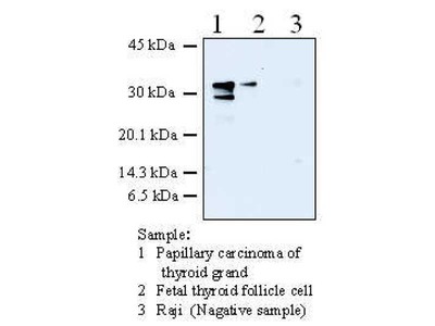 #11102 Anti-Human Galectin-3 (87B5) Mouse IgG MoAb