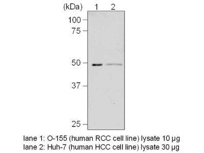 #11106 Anti-Human YB-1 (21A3) Mouse IgG MoAb