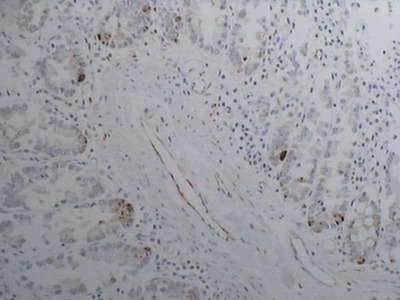 #16201 Anti-Human Endothelin-A Receptor (A405) Rabbit IgG Affinity Purify